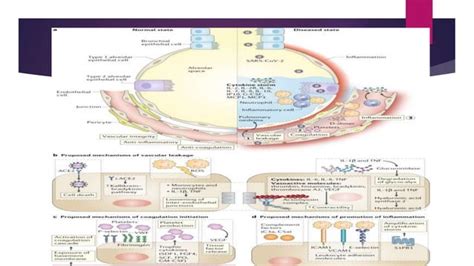 cytokine storm syndrome,pathogenesis and its effect | PPT