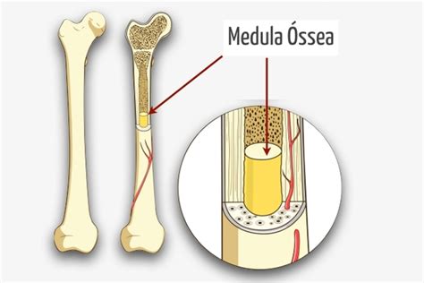 Entenda Como Funciona Um Transplante De Medula Ssea Ictdf Instituto