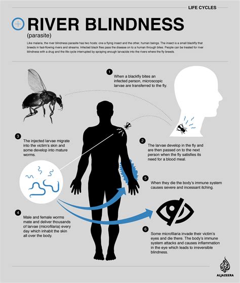 River Blindness Disease - Home Design Ideas