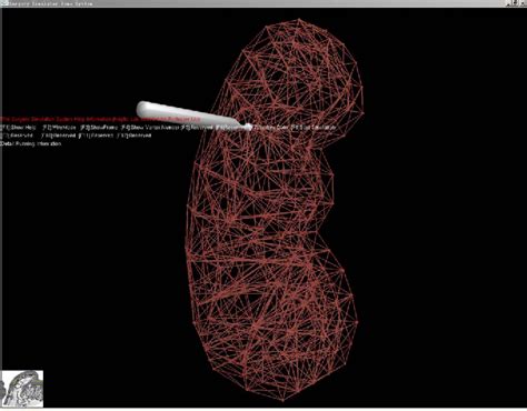 Figure 10 From A New Hybrid Soft Tissue Model For Visio Haptic Simulation Semantic Scholar