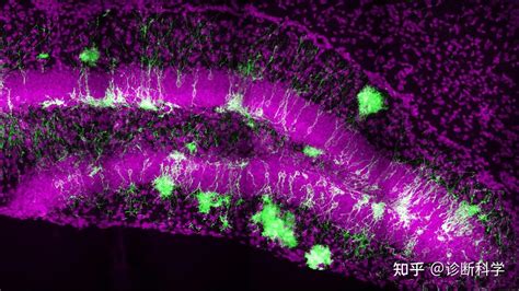 前沿 一种新的液滴单细胞rna Seq方法可以用于单个突触的转录组分析 知乎