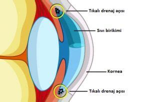 Glokom Hakkinda En Sik Sorulan Sorular Doktorumned O