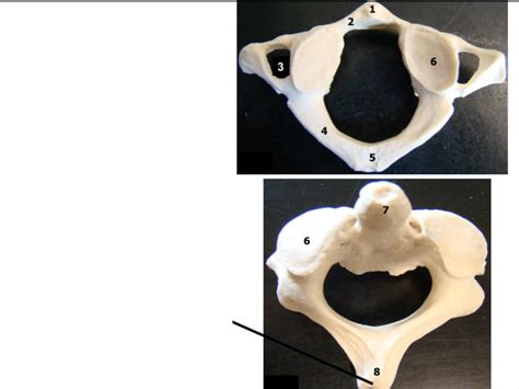 Atlas And Axis Vertebrae Lab Midterm Diagram Quizlet
