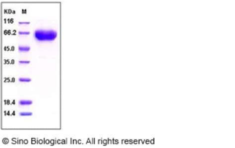 Sino Biological Human Pd Pdcd Protein His Fc Tag Quantity