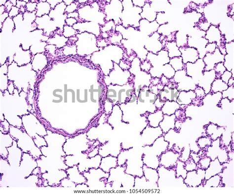 296 Alveoli Histology Images, Stock Photos, 3D objects, & Vectors ...