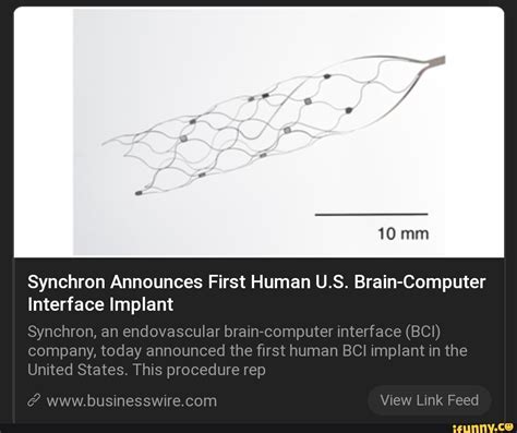 Synchron Announces First Human Us Brain Computer Interface Implant