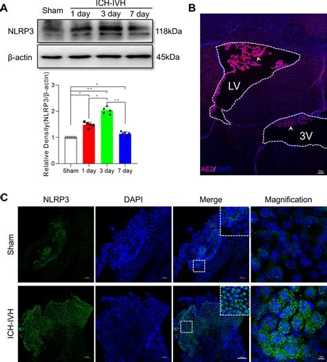 Nlrp Inflammasome Components Were Activated After Ich Ivh In The