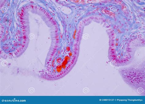 Columnar Epithelium Of Human Gall Bladder Under The Microscope In Lab