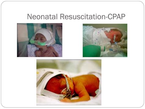 Ppt Neonatal Resuscitation Provider Powerpoint Presentation Free Download Id4502831