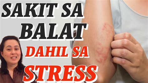 Sakit Sa Balat Dahil Sa Stress By Doc Liza Ramoso Ong YouTube