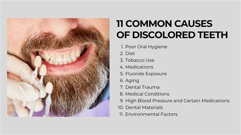 Causes Of Tooth Discoloration