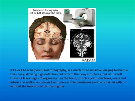 Ppt Medical Imaging Powerpoint Presentation Free Download Id 3006805