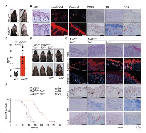 Loss Of Traf In Keratinocytes Causes Epidermal Hyperplasia And