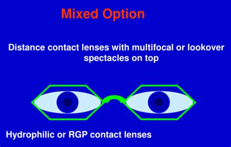 Lecture Contact Lenses For Presbyopia Flashcards Quizlet