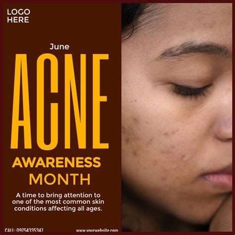 Acne Awareness Month Template Postermywall