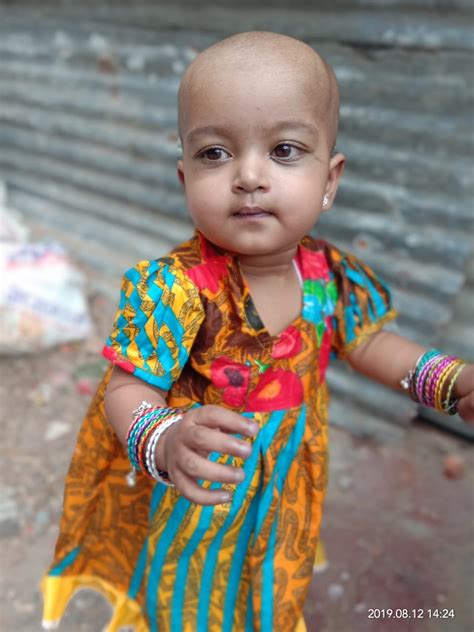 1 Year Old Baby Fatima Is Turning Blue Due To Underdeveloped Heart