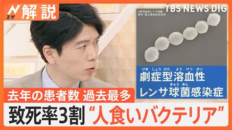 致死率3割“人食いバクテリア”去年の患者数が過去最多、感染経路は傷口から予防策は？【nスタ解説】 Tbs News Dig 2ページ