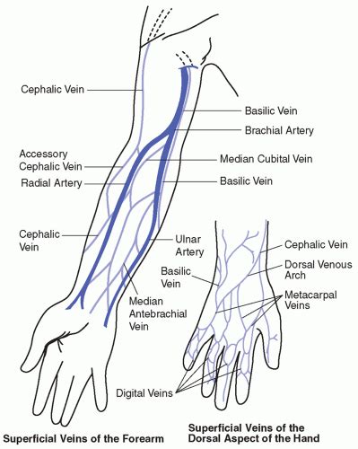 Peripheral Venous Access Oncohema Key