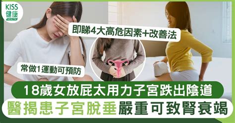 子宮下垂｜18歲女放屁太用力子宮跌出陰道 嚴重可致腎衰竭 附1運動預防