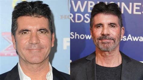 Simon Cowell Plastic Surgery, Simon Cowell Before And After Plastic ...