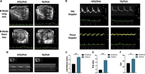 Frontiers Modifications Of Sarcoplasmic Reticulum Function Prevent