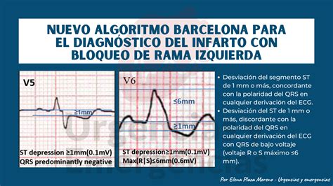 Haz Un Experimento Mayor Hacer La Cama Bloqueo Completo De Rama Derecha