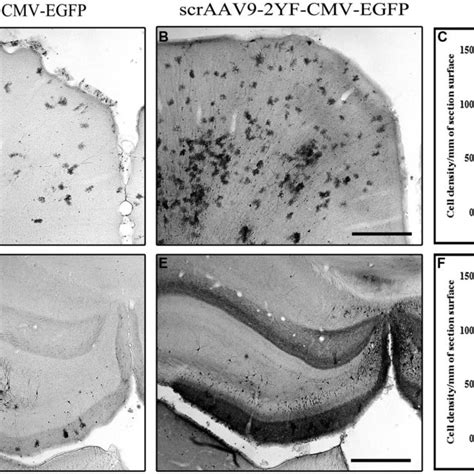 Kainic Acid Ka Induced Microglial Activation Evidenced By Cd B