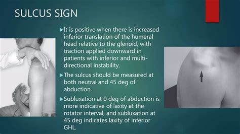 Recurrent Shoulder Dislocation And Management PPT