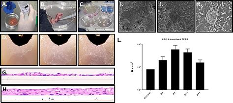 Frontiers Development Of A Novel Ex Vivo Nasal Epithelial Cell Model