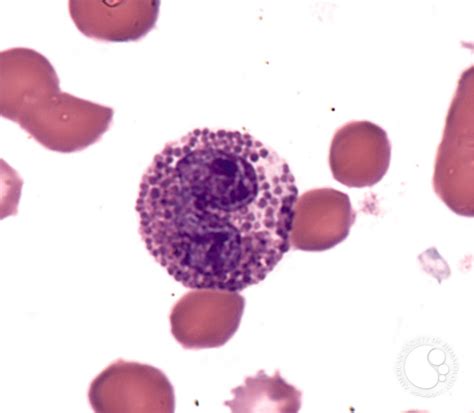 Eosinophil - 1.