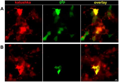 Fluorescence microscopy of HEK293T cells transiently expressing target ...