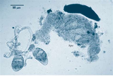 Light Microscope Photograph Of Bucephalid Sporocyst Spo Sporocyst