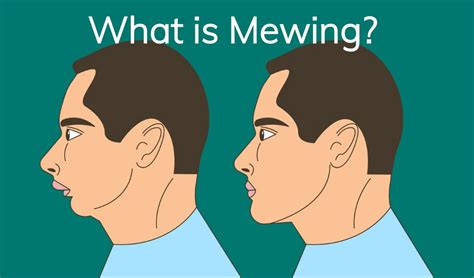 What Is Mewing The Benefits Of Proper Oral Posture 10 In Progress