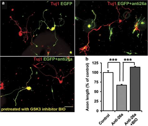 Mir 26a Gsk3β Regulate Sensory Axon Regeneration By Controlling Gene