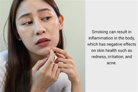 Reasons Why Quitting Smoking Is Good For Your Skin