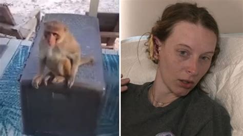 Loose Pet Monkey In Oklahoma Attacks Woman And Rips Part Of Her Ear Off