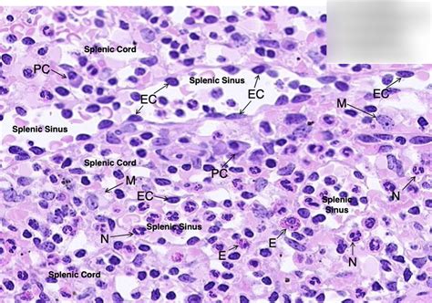 Spleen Diagram Quizlet