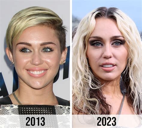 Miley Cyrus Fans Speculate She Had Plastic Surgery After Seeing