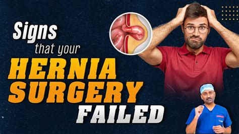 Failed Hernia Surgery Symptoms Signs That Your Hernia Repair Failed Dr Parthasarathy Youtube