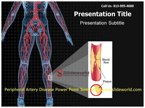 Peripheral Artery Disease Powerpoint Template