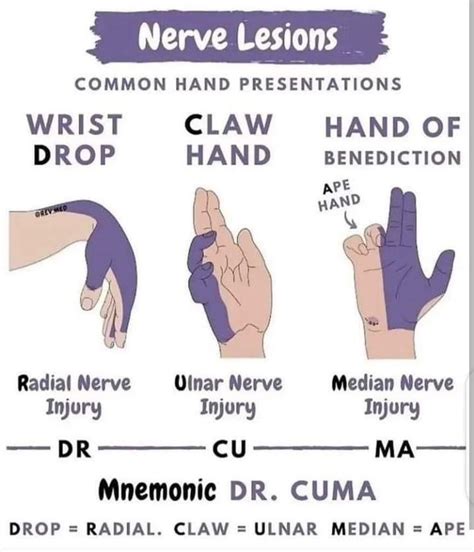 Hand Exam : r/FOAMed911