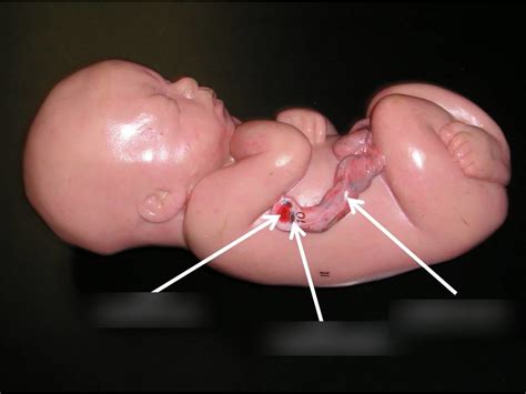 Fetus Diagram Quizlet