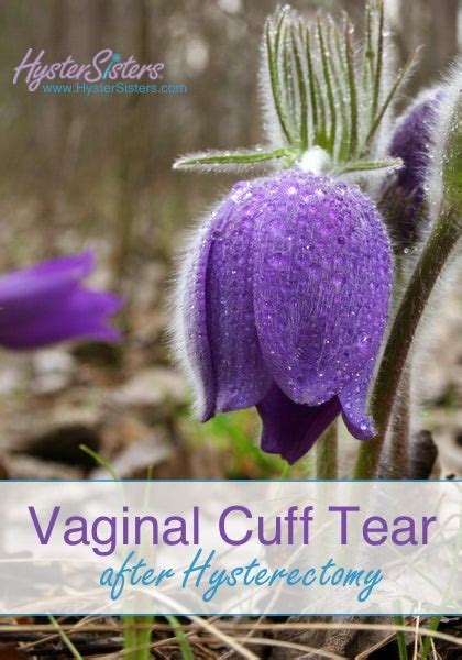 Vaginal Cuff Tear After Hysterectomy Hysterectomy Recovery Article