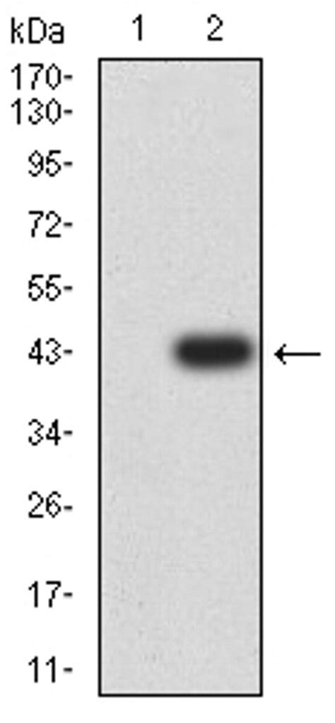 Tet2 Monoclonal Antibody 5h8c7 Ma5 38640