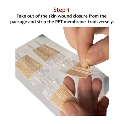 China Medical Surgical Sterile Adhesive Emergency Wound Closures Strips Suppliers Manufacturers