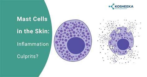 Mast Cells in the Skin: Inflammation Culprits? - Kosheeka