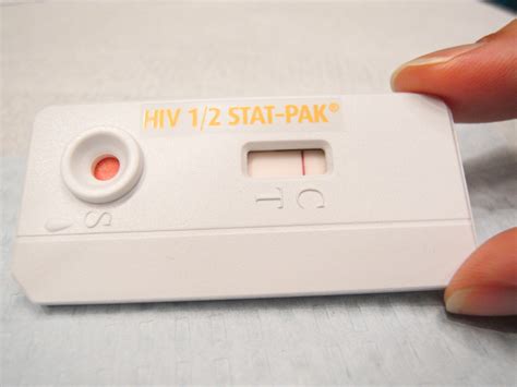 How Long Before Getting HIV Test Results – Tests to Diagnose HIV