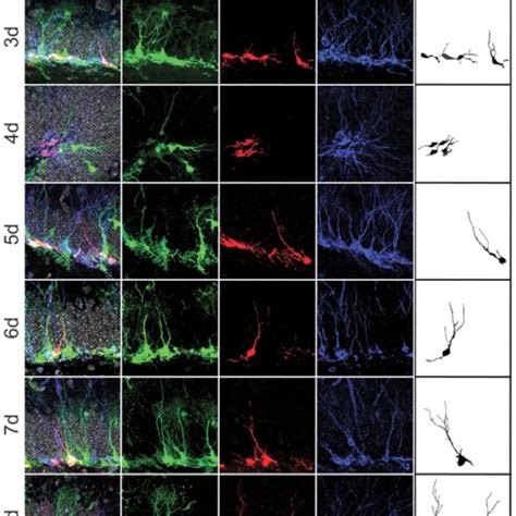 Dendritic Growth Pattern In Slice Cultures Versus Snapshot Based In