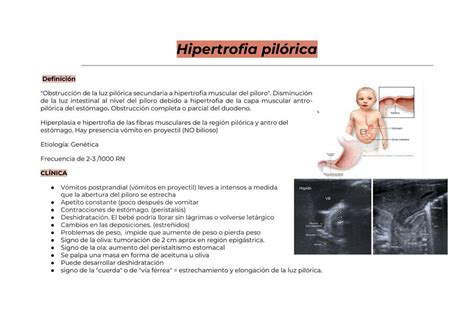 Estenosis Pil Rica Angela Dominguez Udocz