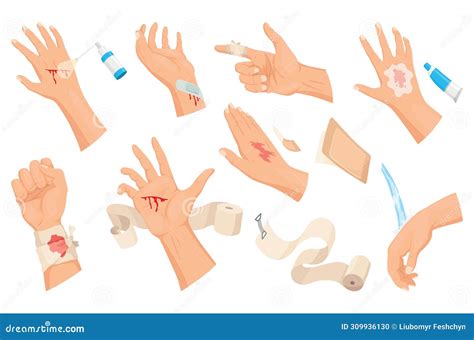 Hands Injured Skin And Procedures Of Bandaging First Aid For Wound